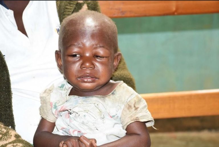 Crise Humanitaire à Lubero : OCHA publie le Rapport de l’Évaluation Rapide Multisectorielle menée par la Caritas Butembo-Beni en zone de santé d’Alimbongo