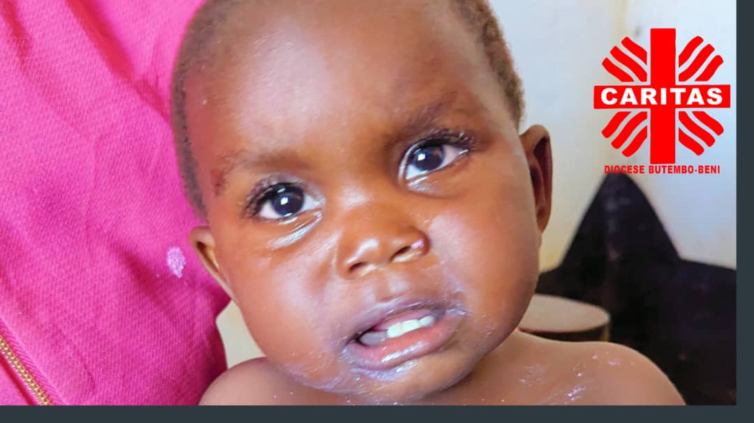 Distribution de la bouillie en ZS Biena 25VJuin 2025